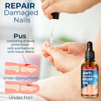 Reparador de uñas de máxima potencia