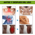 Beevana™ Crema de veneno de abeja Multifuncional - COMPRE 1 LLEVE 2