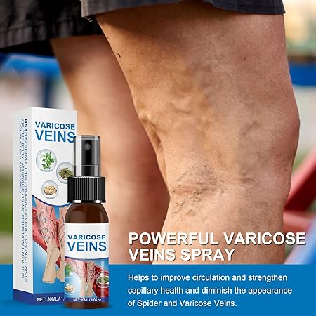 Spray tratamiento para Varices y Arañitas