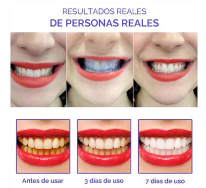 CleanMax -Crema Purpura Blanqueadora de Dientes | Compra 1 LLEVA 2