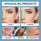 SERUM ÁCIDO HIALURONICO