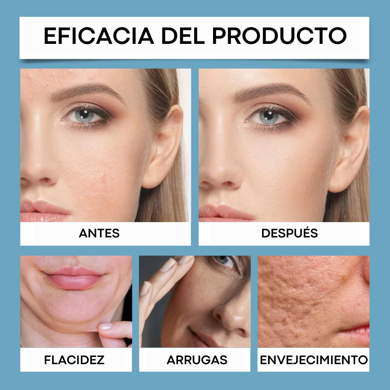 SERUM ÁCIDO HIALURONICO