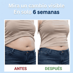 Keto Burn | Chupa-Panza