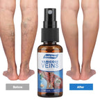 Spray tratamiento para Varices y Arañitas